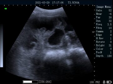 bu201 ultrasound scanner with mechanical probe chek pregnancy 20210329 171706