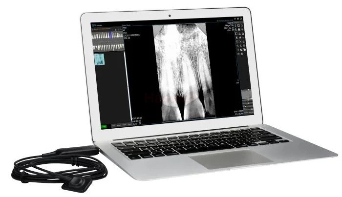 Portable Pets X-Ray Camera 08 with free of charge software manufacturer - China Haswell